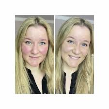 Rosalique 3 in 1 Anti-Redness Miracle Formula SPF50 - 30ml